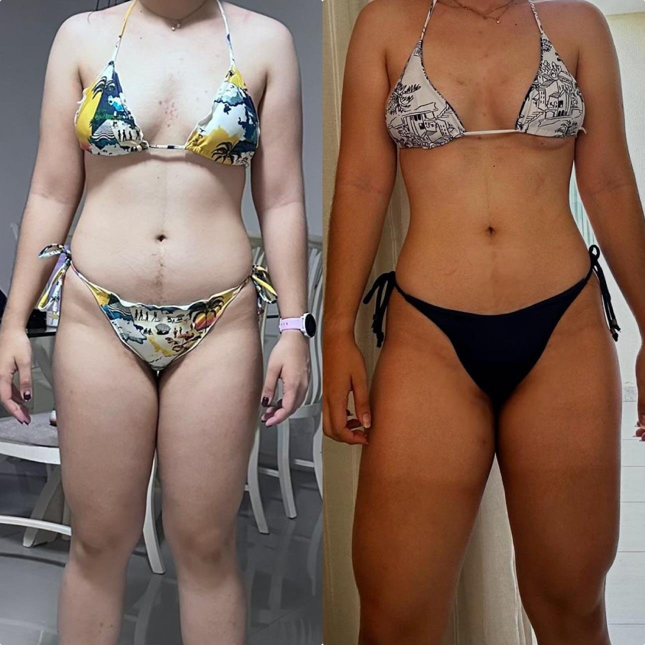 Antes e Depois Cliente 2