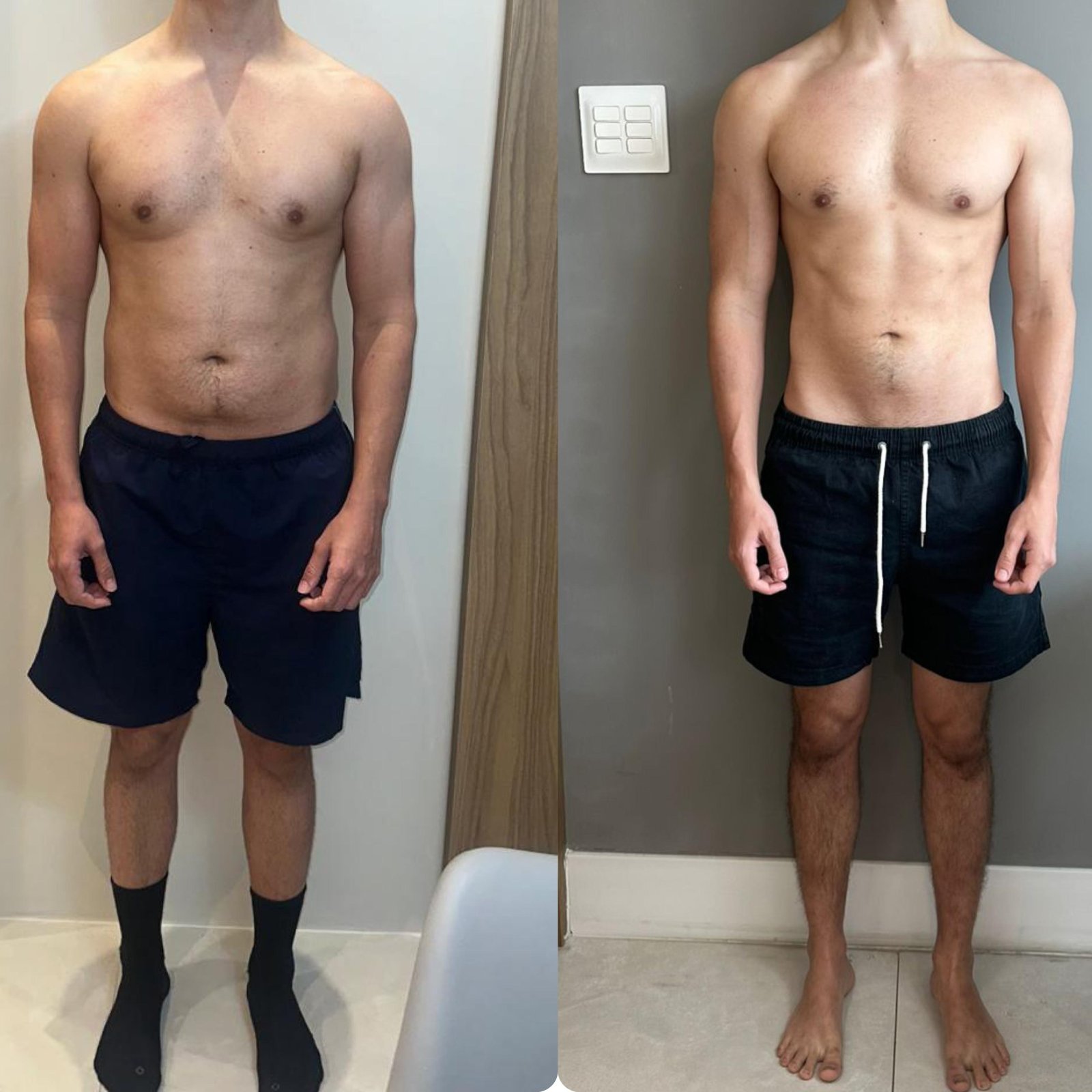 Antes e Depois Cliente 3